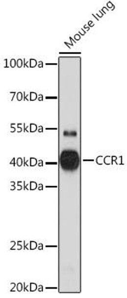 Anti-CCR1 Antibody (CAB18341)