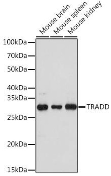 Anti-TRADD Antibody (CAB18626)