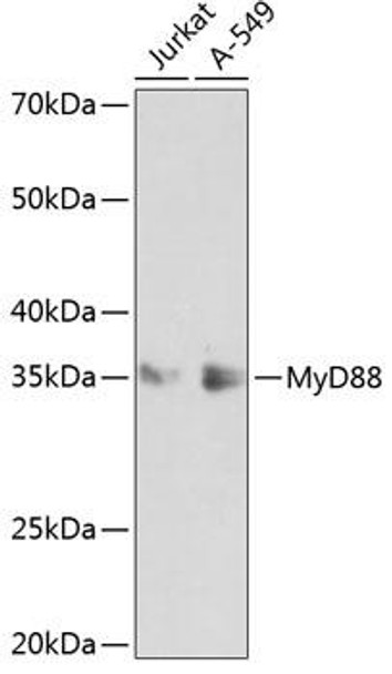 Anti-MyD88 Antibody [KO Validated] (CAB19082)