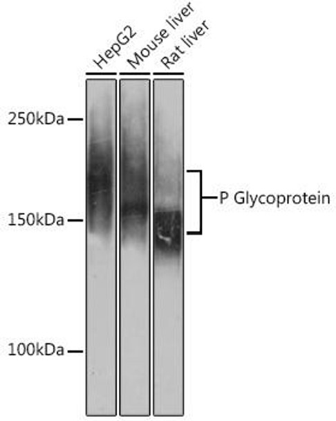 Anti-P Glycoprotein Antibody (CAB19093)