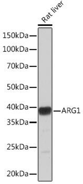Anti-ARG1 Antibody (CAB4923)