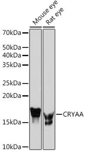 Anti-CRYAA Antibody (CAB5111)