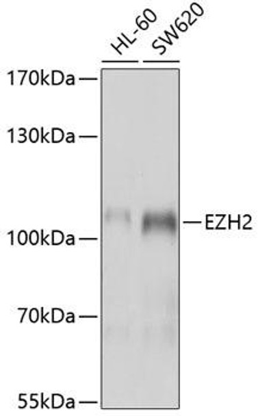 Anti-EZH2 Antibody (CAB5743)