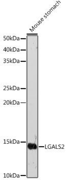 Anti-LGALS2 Antibody (CAB6645)