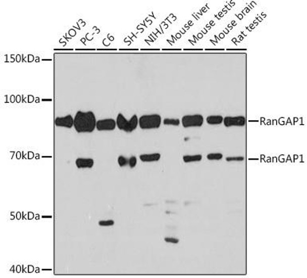 Anti-RanGAP1 Antibody (CAB8758)