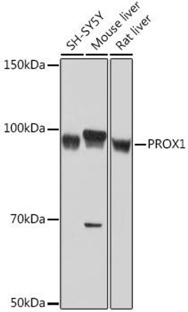 Anti-PROX1 Antibody (CAB9047)
