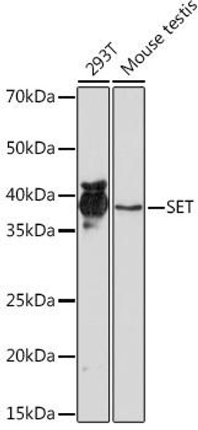 Anti-SET Antibody (CAB9173)