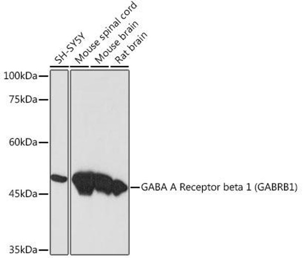 Anti-GABA A Receptor beta 1 (GABRB1) Antibody (CAB19681)