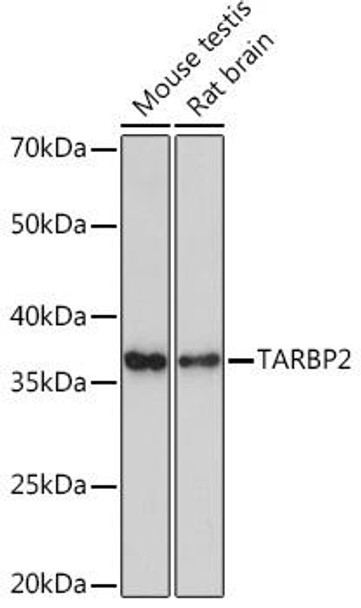 Anti-TARBP2 Antibody (CAB9105)