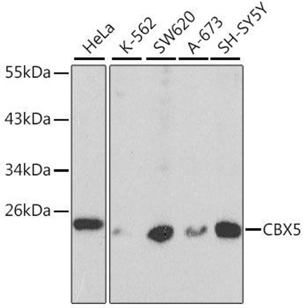 Anti-CBX5 Antibody (CAB1098)[KO Validated]