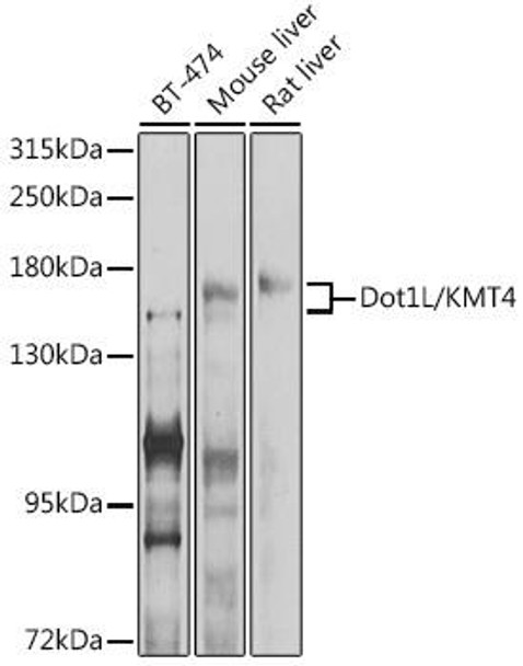 Anti-Dot1L/KMT4 Antibody (CAB11286)
