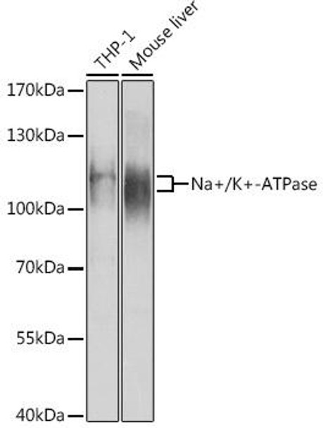 Anti-Na+/K+-ATPase Antibody (CAB12405)