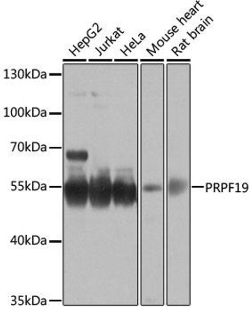 Anti-PRPF19 Antibody (CAB12590)