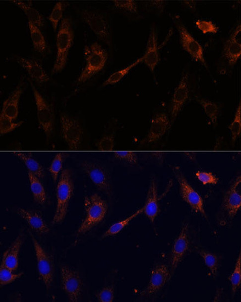 Anti-VPS25 Antibody (CAB13132)