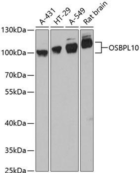 Anti-OSBPL10 Antibody (CAB13199)