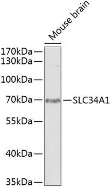 Anti-SLC34A1 Antibody (CAB13634)