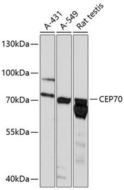 Anti-CEP70 Antibody (CAB13883)