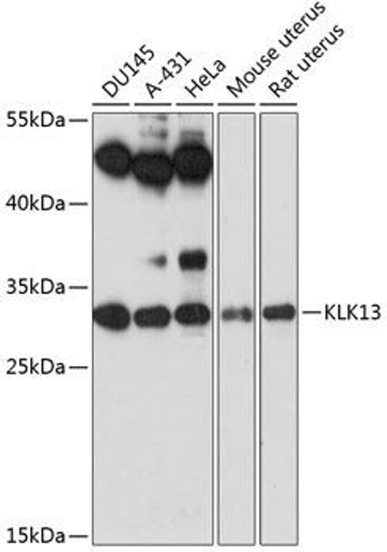 Anti-KLK13 Antibody (CAB14274)