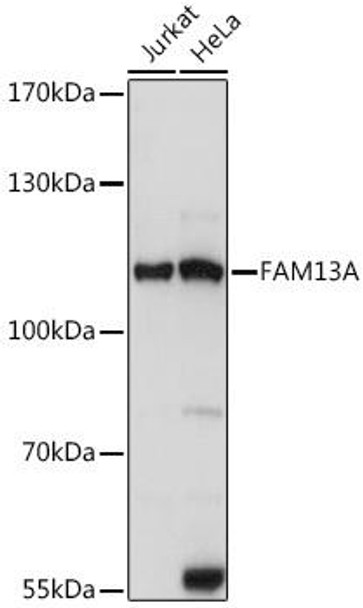 Anti-FAM13A Antibody (CAB14576)