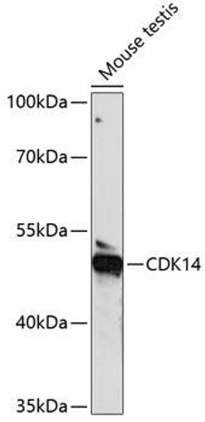 Anti-CDK14 Antibody (CAB14986)