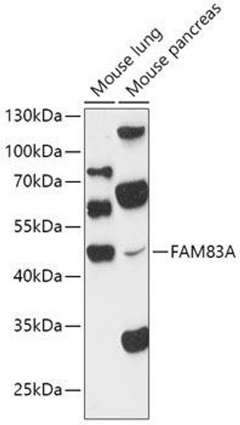 Anti-FAM83A Antibody (CAB15201)