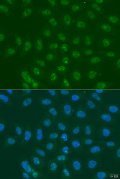 Anti-LSM11 Antibody (CAB15210)