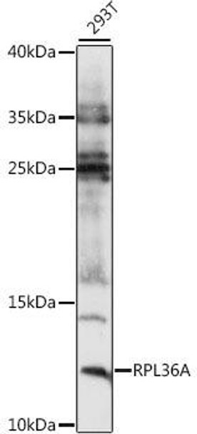 Anti-RPL36A Antibody (CAB15717)