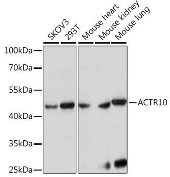 Anti-ACTR10 Antibody (CAB15867)