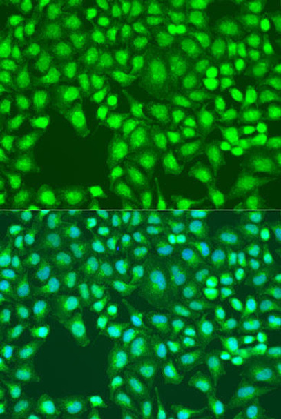 Anti-Defb26 Antibody (CAB15903)