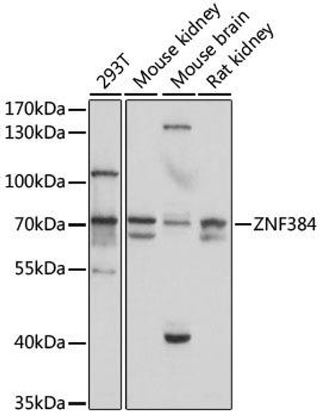 Anti-ZNF384 Antibody (CAB15964)