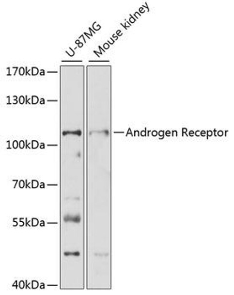 Anti-Androgen Receptor Antibody (CAB16200)