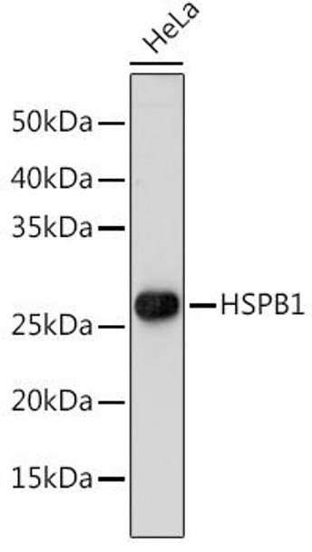 Anti-HSPB1 Antibody (CAB16332)[KO Validated]
