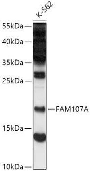 Anti-FAM107A Antibody (CAB16494)