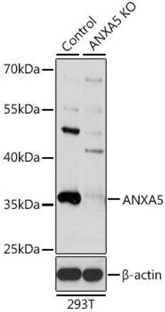 Anti-ANXA5 Antibody (CAB1728)[KO Validated]