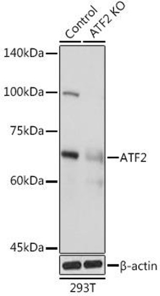 Anti-ATF2 Antibody (CAB2155)[KO Validated]