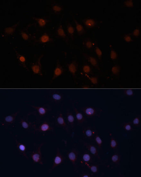 Anti-TOM70 Antibody (CAB4349)