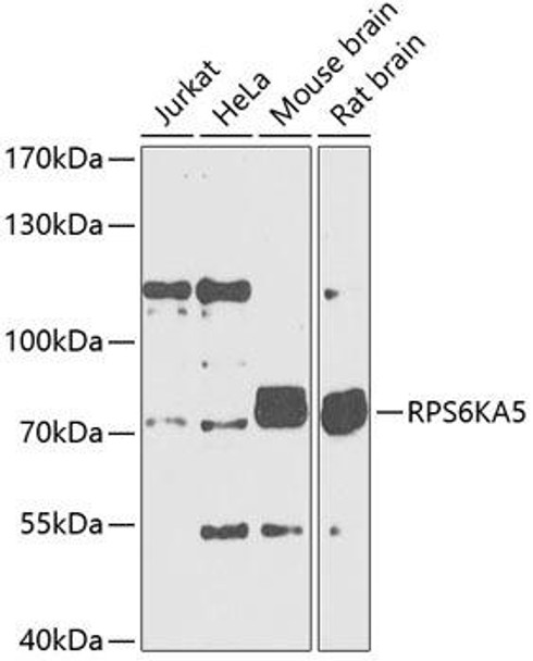 Anti-RPS6KA5 Antibody (CAB5699)