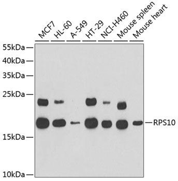 Anti-RPS10 Antibody (CAB6056)