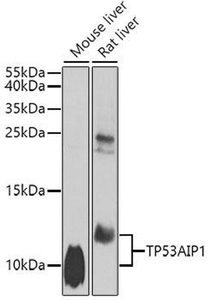 Anti-TP53AIP1 Antibody (CAB7224)