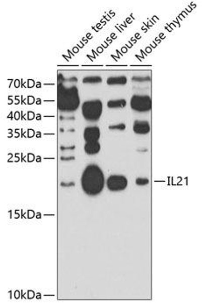 Anti-IL-21 Antibody (CAB7235)