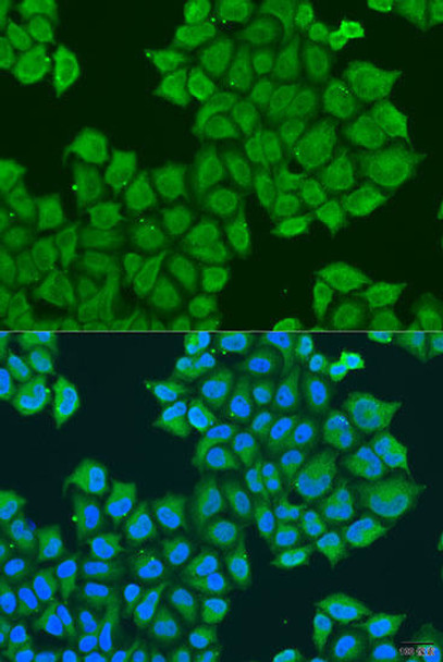 Anti-Syntaxin-12 Antibody (CAB8200)