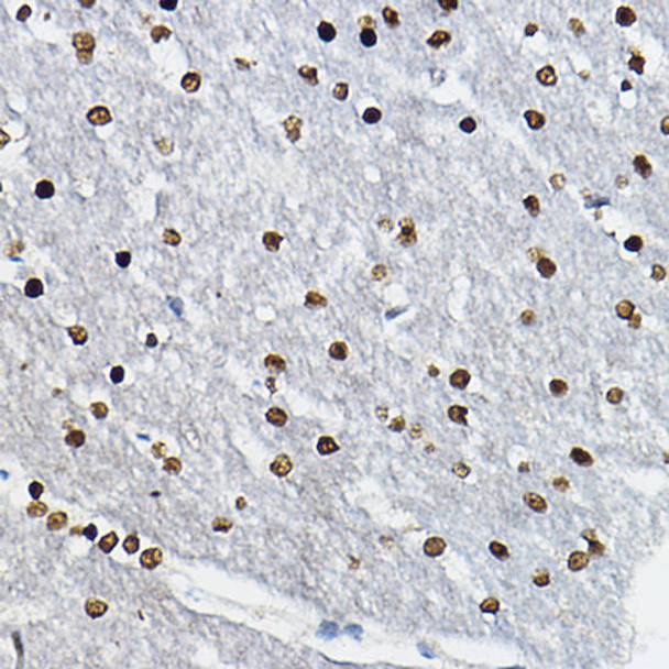 Anti-SOX10 Antibody (CAB8635)