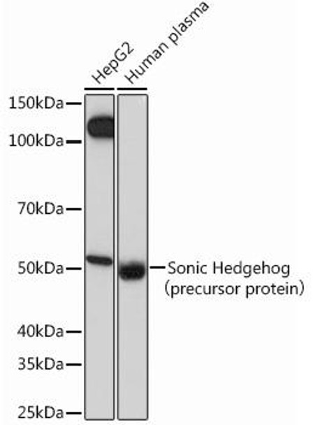 Anti-Sonic Hedgehog Antibody (CAB12695)