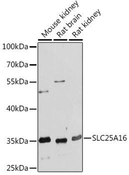 Anti-SLC25A16 Antibody (CAB17016)