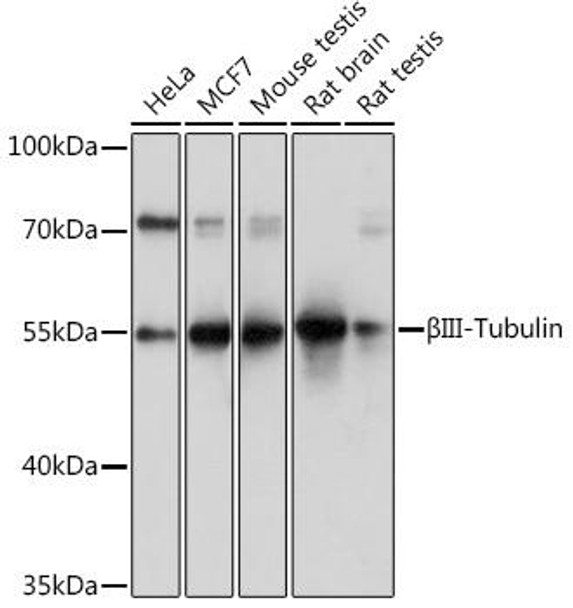 Anti-BetaIII-Tubulin Antibody (CAB17073)