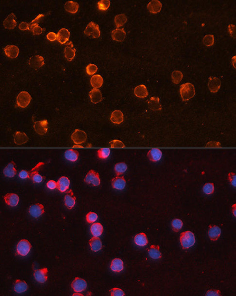 Anti-IL-10 Antibody (CAB17501)