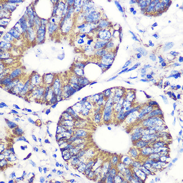 Anti-TNC Antibody (CAB18156)