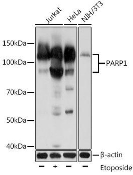 Anti-PARP1 Mouse Monoclonal Antibody (CAB18303)