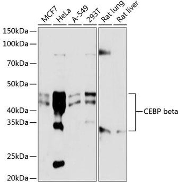 Anti-CEBP beta Antibody (CAB19538)