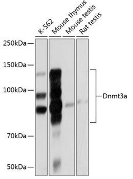 Anti-Dnmt3a Antibody [KO Validated] (CAB19659)